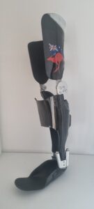 Carbon Fibre KAFO with Fior and Gentz and Custom Kangaroo print