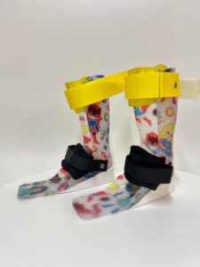 Thermoplastic AFO with Supergirl Design
